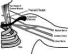 Thoracic Outlet "Thumbnail"